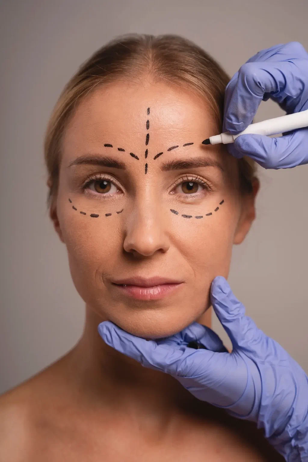Blepharoplasty Procedure